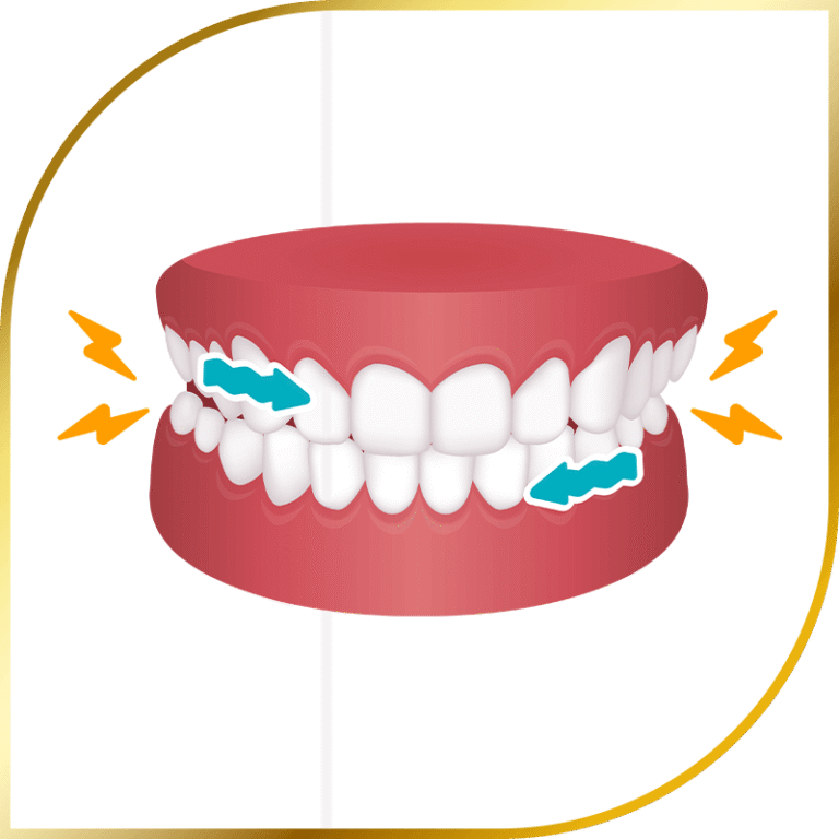 Plaque bacteria teeth
