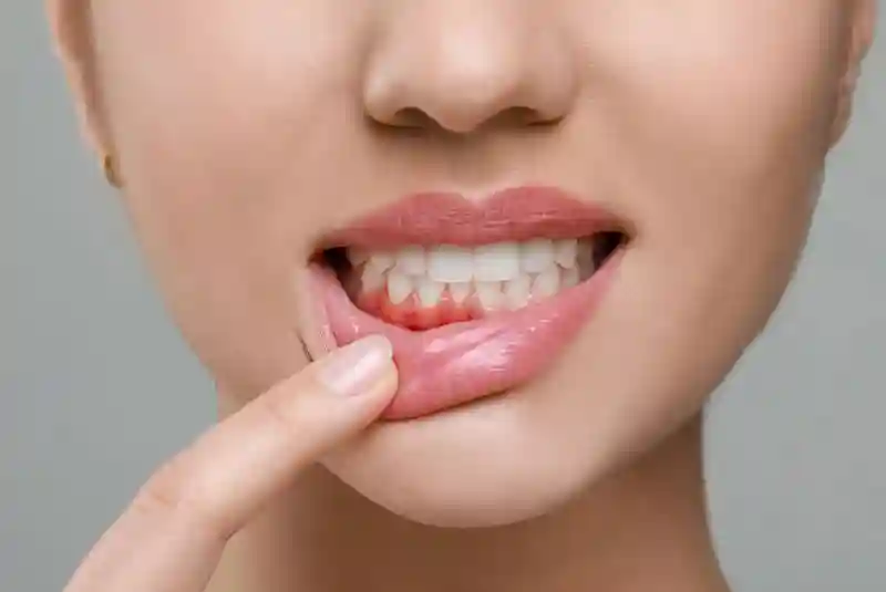 periodontaltherapy5050